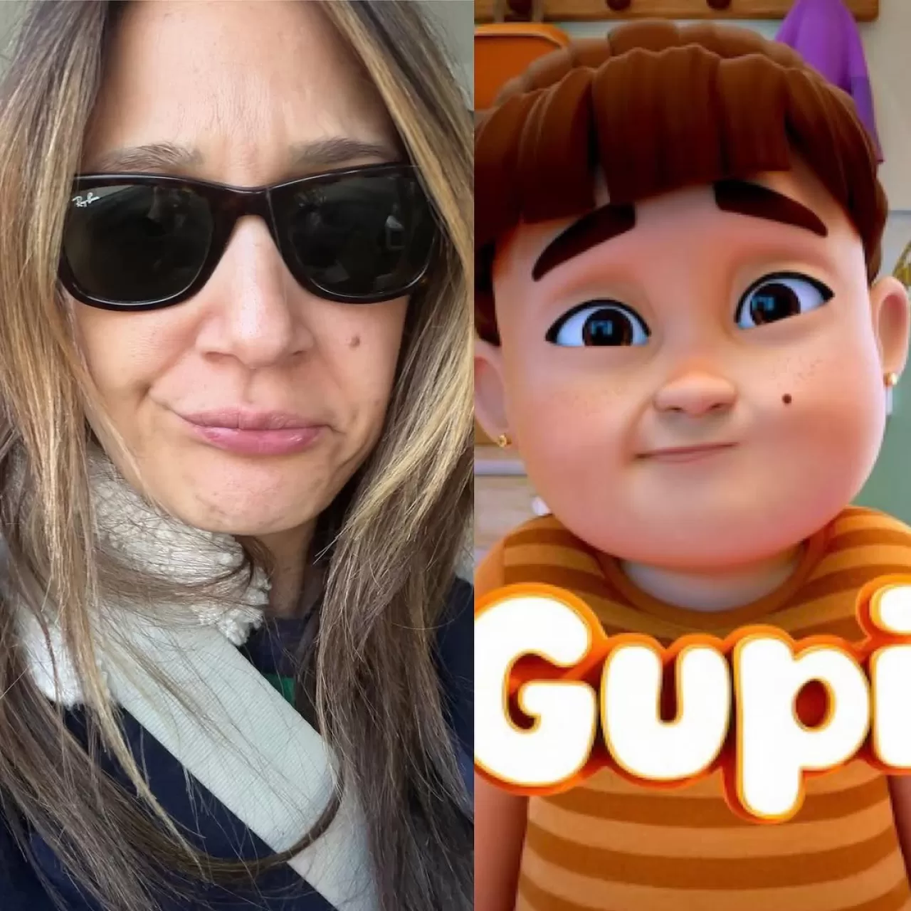 Gupse Özay Kestane Yerken Dişini Kırdı, İmplant Yaptırdı