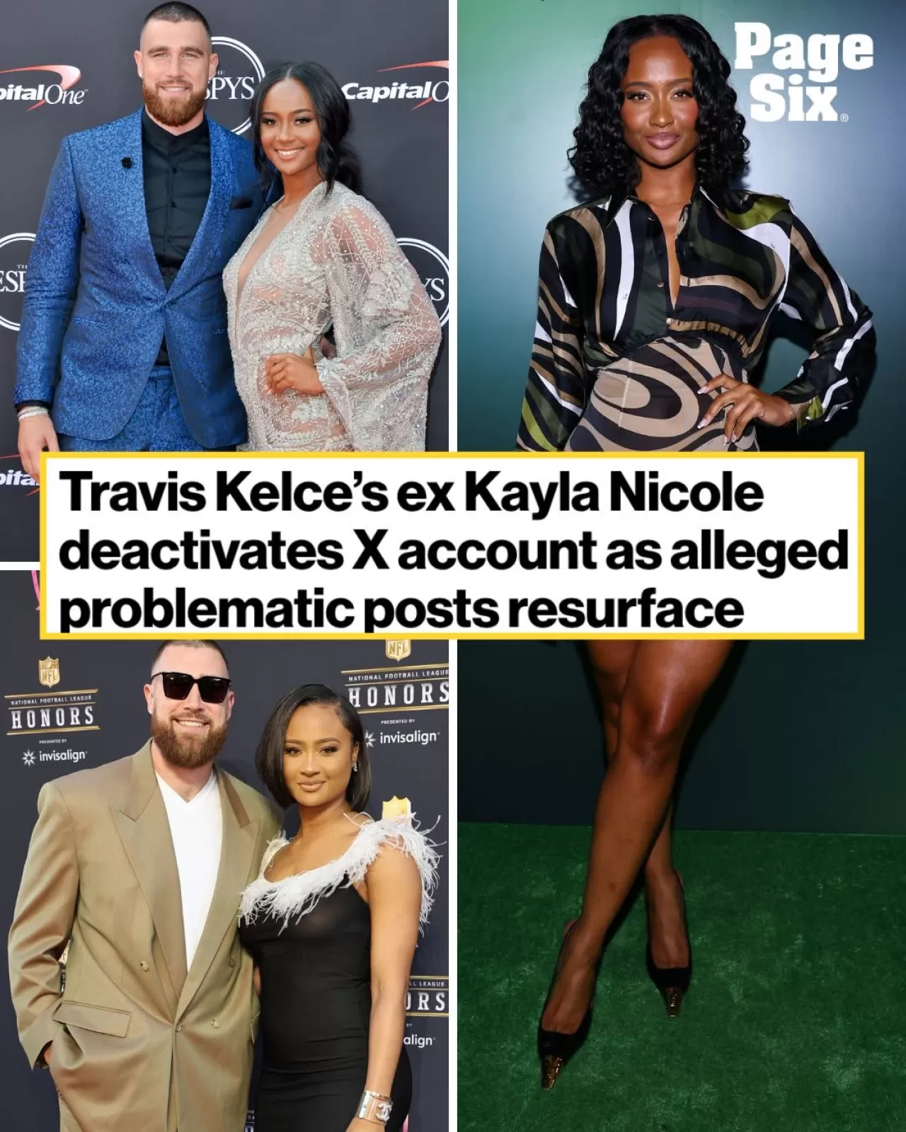 Kayla Nicole, Eski Sosyal Medya Paylaşımlarının Gündeme Gelmesinin Ardından X Hesabını Kapattı