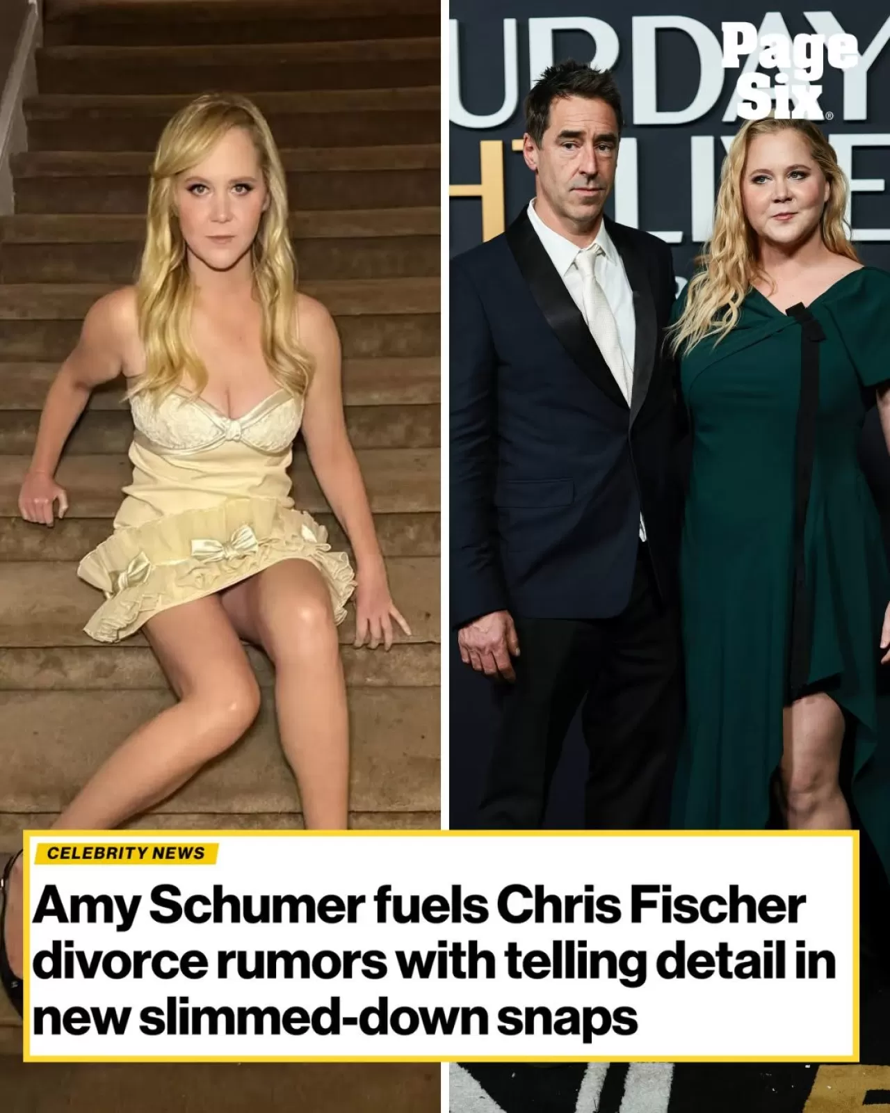 Amy Schumer'ın Sosyal Medya Paylaşımı Gündem Oldu