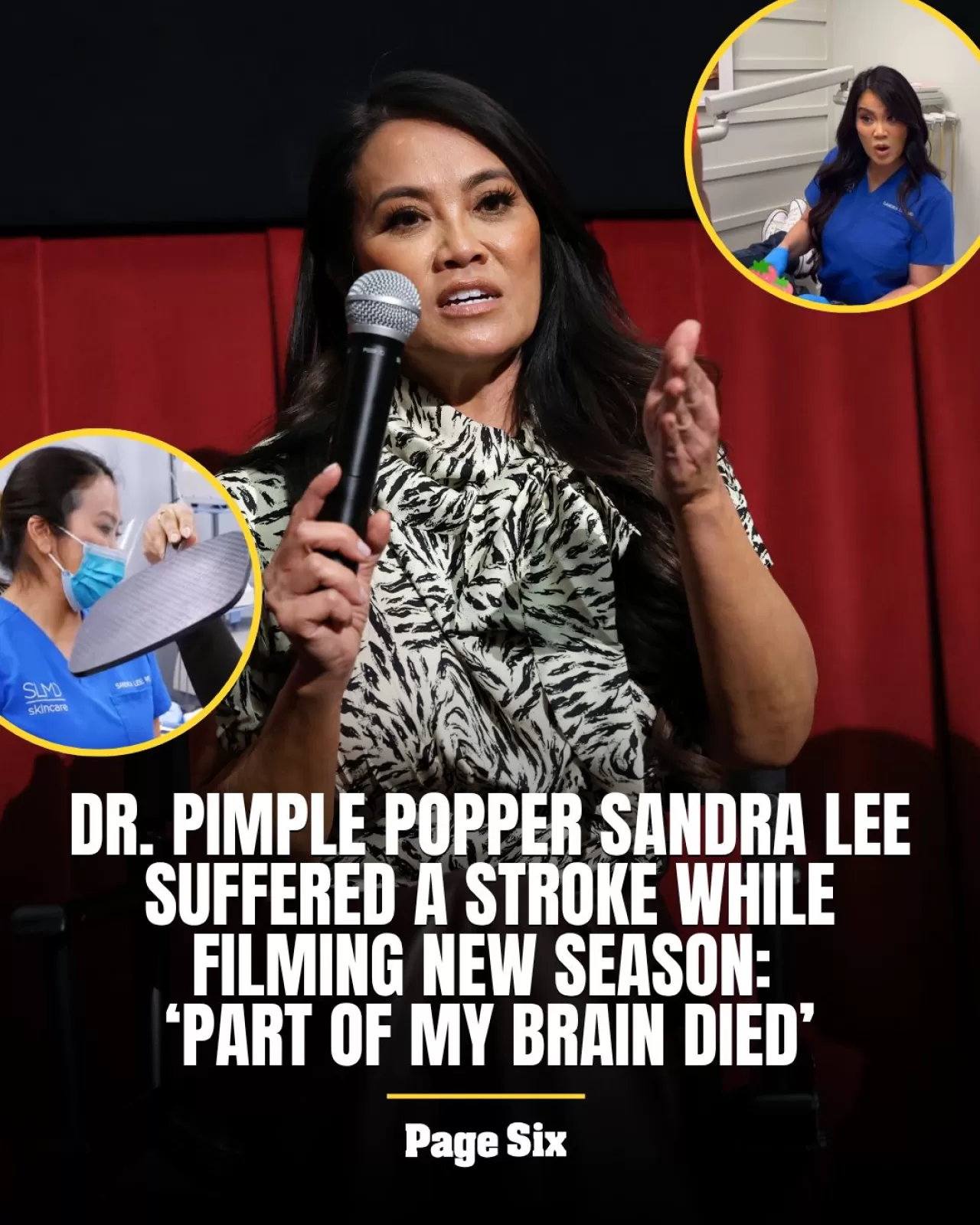 Dr. Pimple Popper Felç Geçirdi: