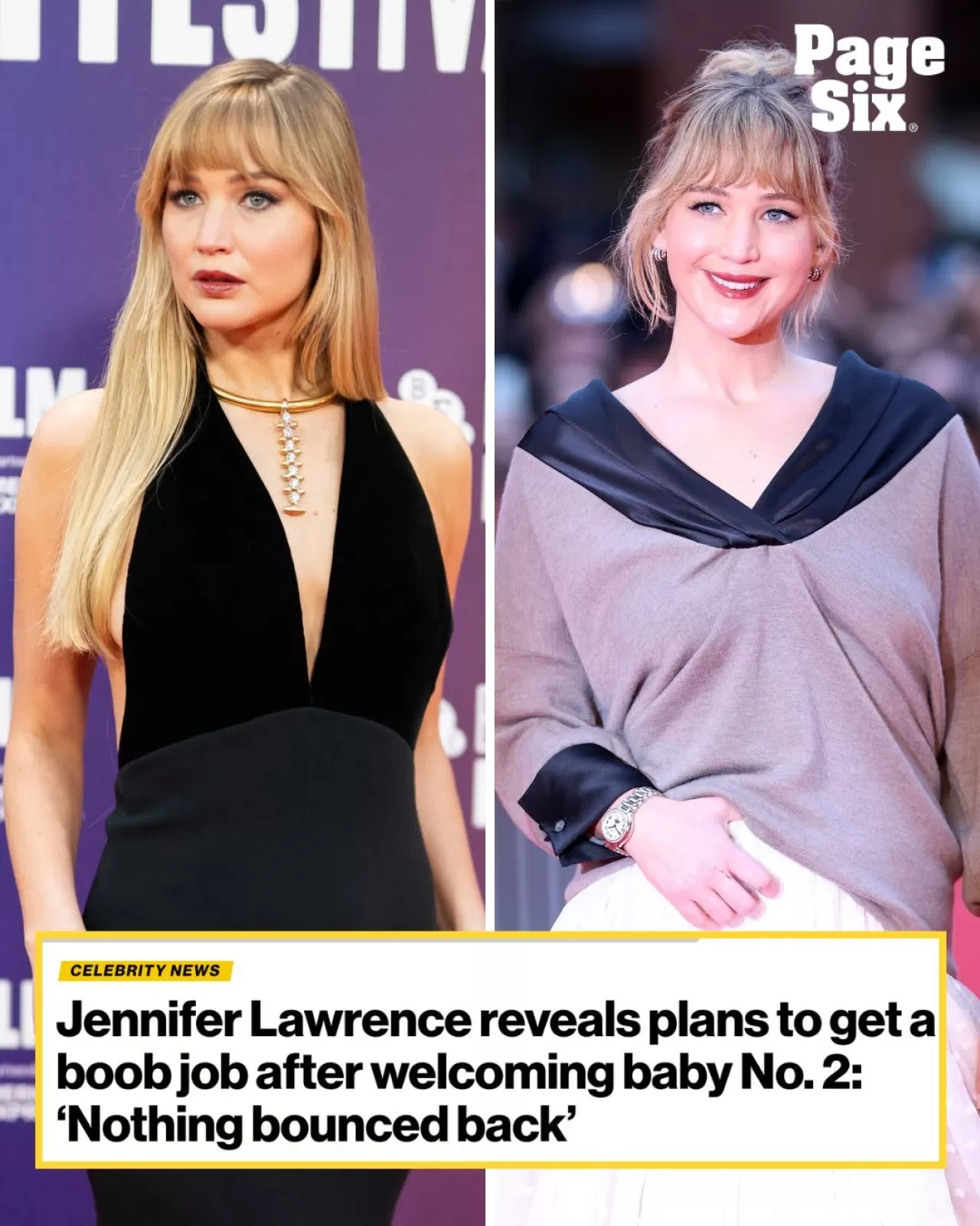 Jennifer Lawrence Doğum Sonrası Estetik Ameliyat Planlarını Açıkladı